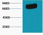 Transferrin Ab