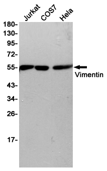 Vimentin Ab