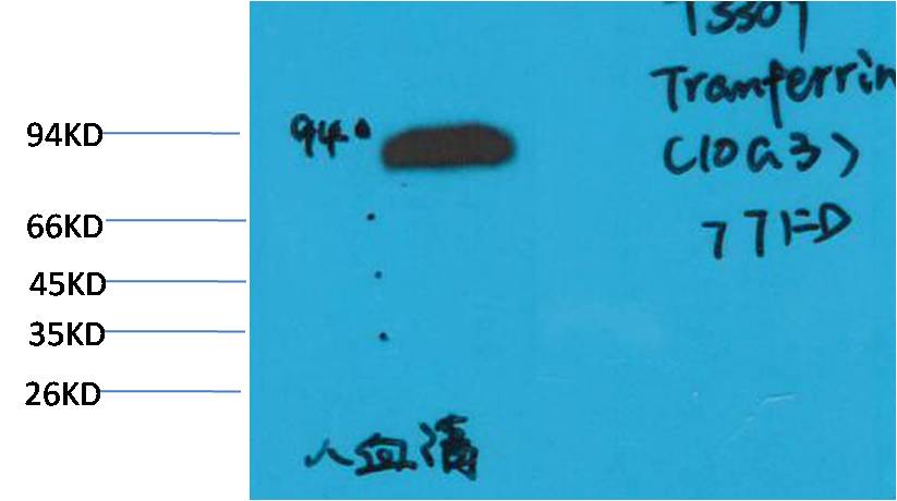 Transferrin Ab