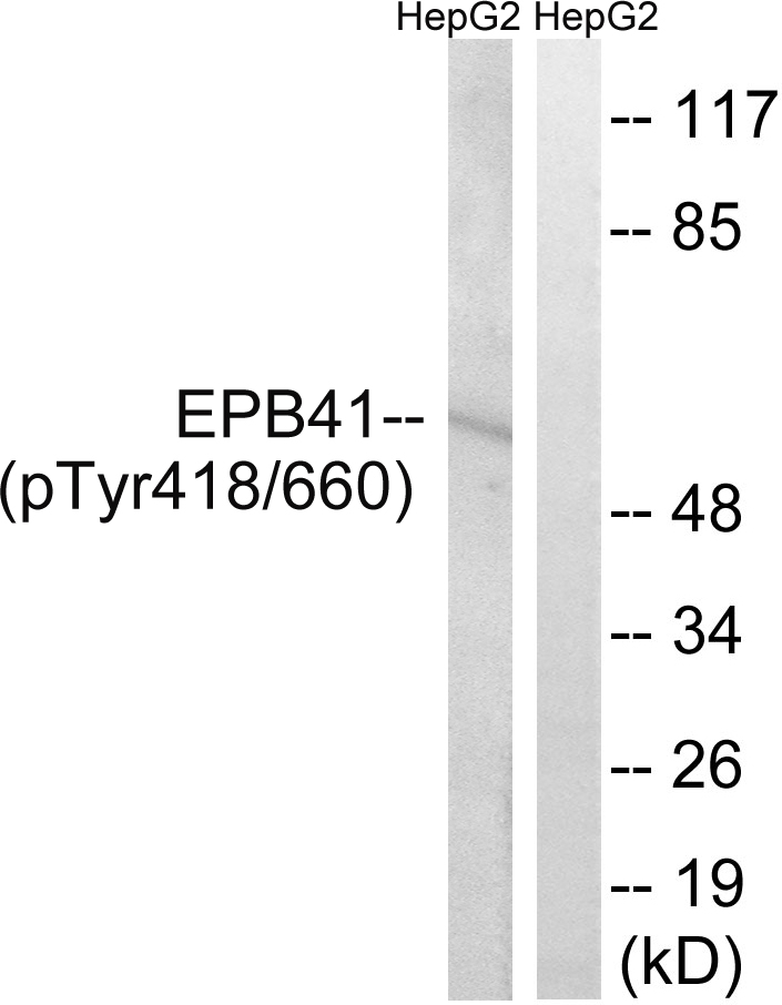 p-EPB41 (Y660) Ab