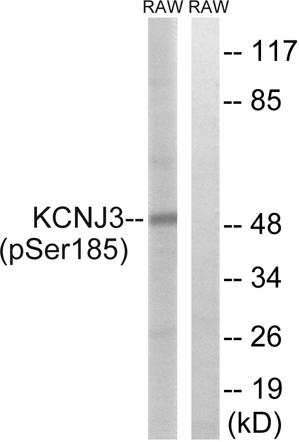 p-GIRK 1 (S185) Ab