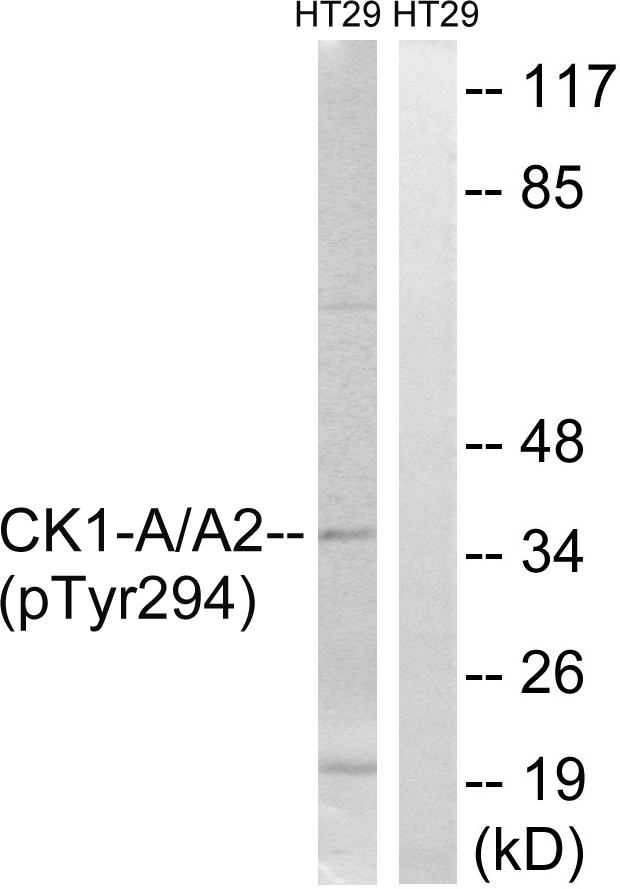 p-CKI alpha/CKI alpha like (Y294) Ab