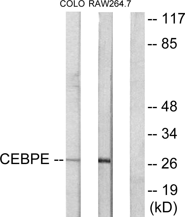 CEBP alpha/epsilon Ab