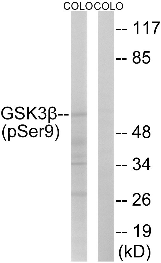p-GSK3 beta (S9) Ab