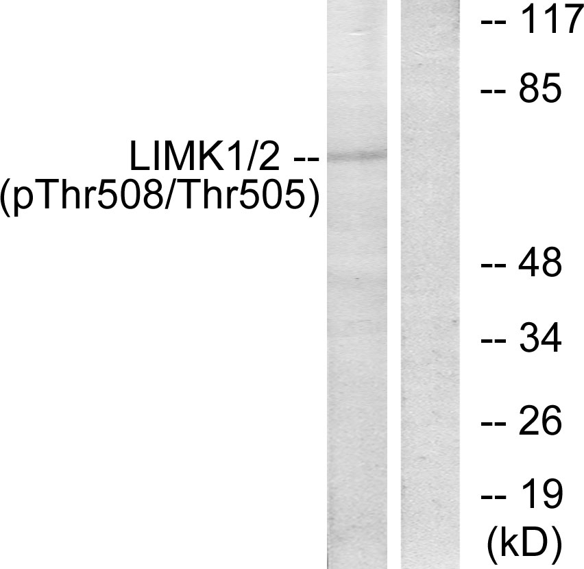 p-LIMK 2 (T505) Ab