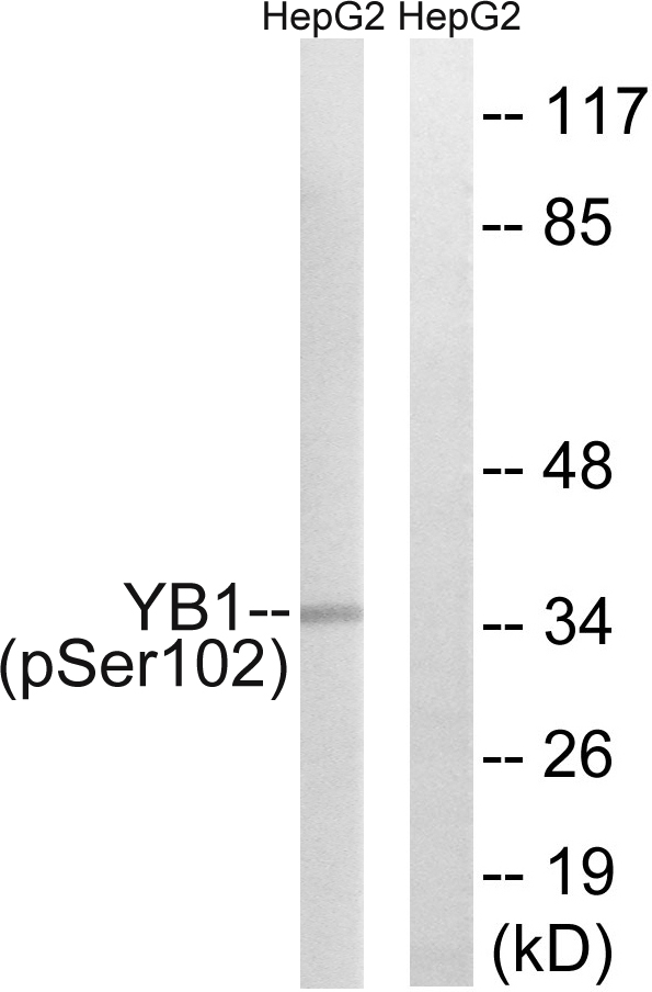 p-YB1 (S102) Ab