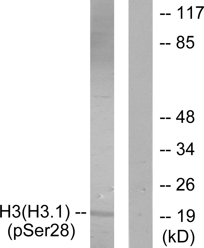 p-Histone H3 (S28) Ab