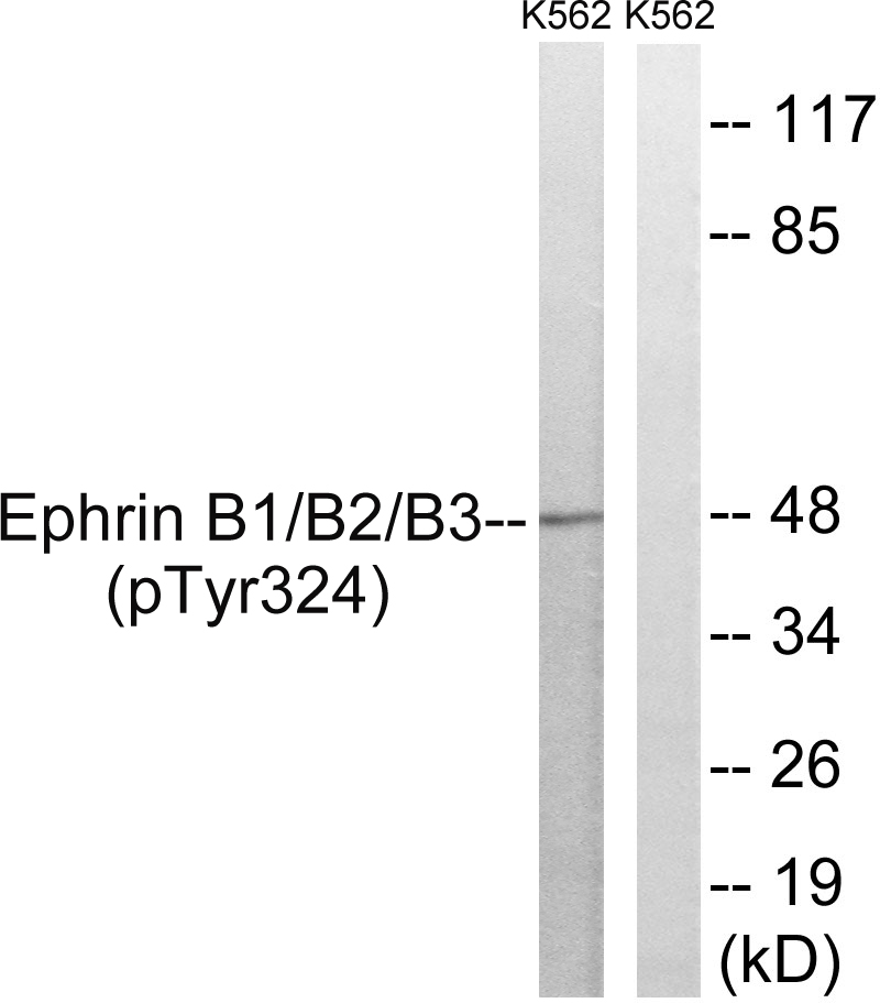 p-Ephrin B1/B2/B3 (Y324/Y330/Y323) Ab