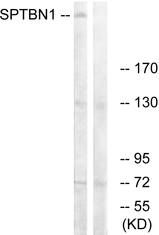 SPTBN1 Ab