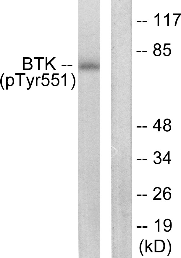 p-BTK (Y551) Ab