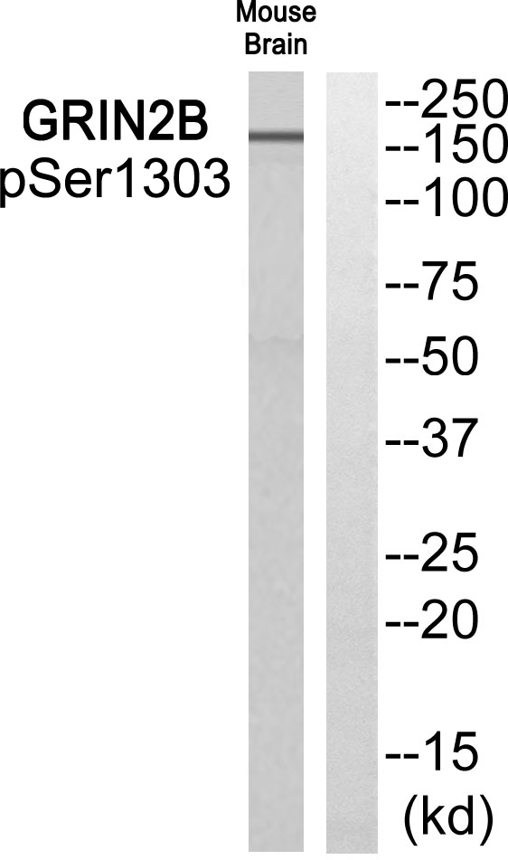 p-GluN2B (S1303) Ab