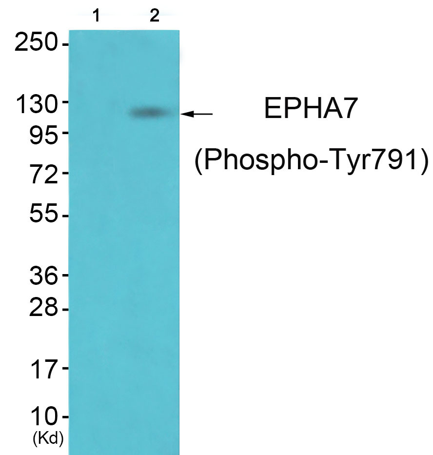 p-Ephrin A receptor 7 (Y791) Ab