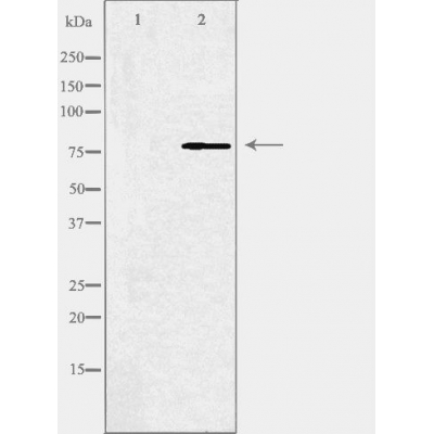 ABCB10 Ab