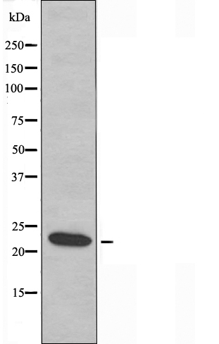 AKAP 14 Ab