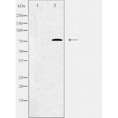C1S Ab