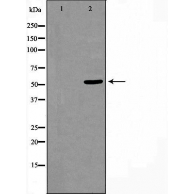 CELF 1 Ab