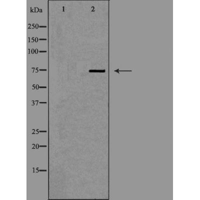 DCP1A Ab