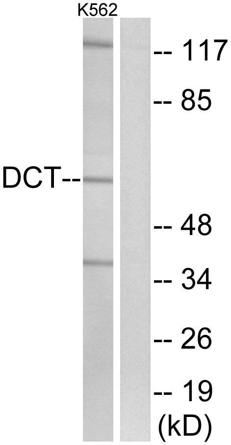 DCT Ab