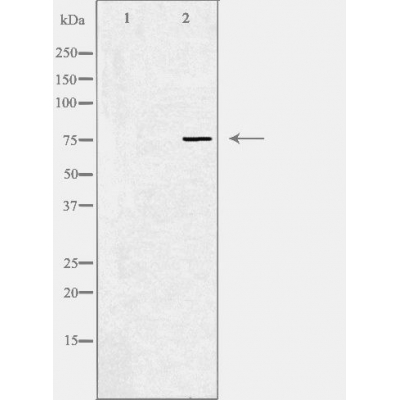 beta Galactosidase Ab
