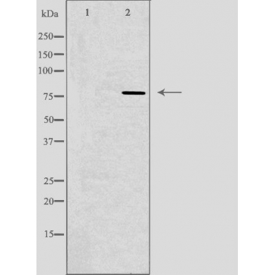 beta Glucuronidase Ab