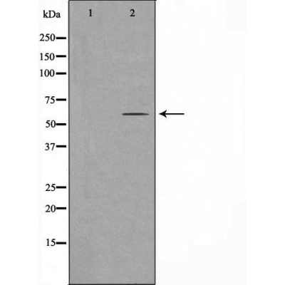 Histidine tRNA ligase Ab