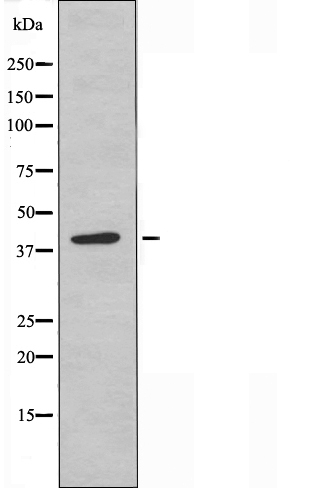 NDUFA9 Ab