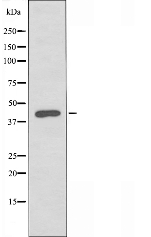 Neurotrimin Ab