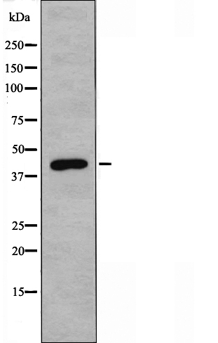 NTR1 Ab