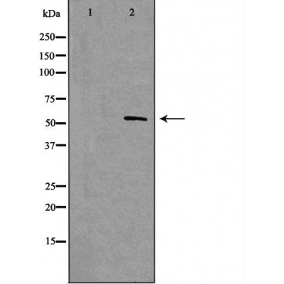 NF1 A/B/C/X Ab