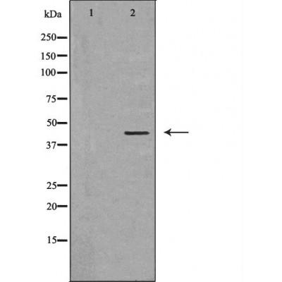 PDHA1 Ab