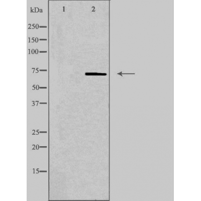 cPLA2 gamma Ab