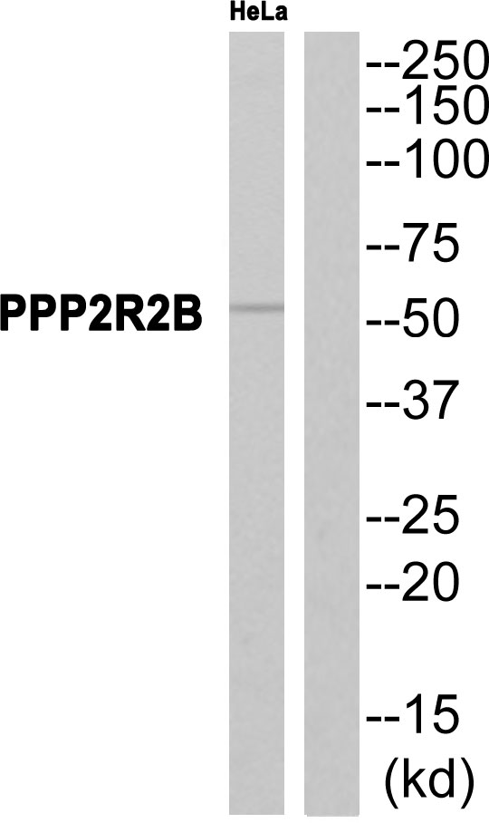 PPP2R2B Ab