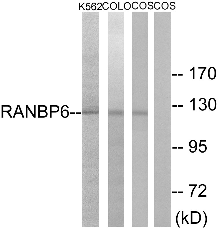 RanBP6 Ab