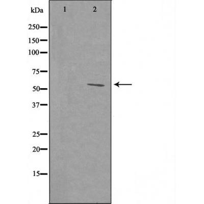 RPL39 Ab