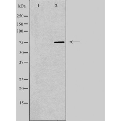 SLCO1B1 Ab