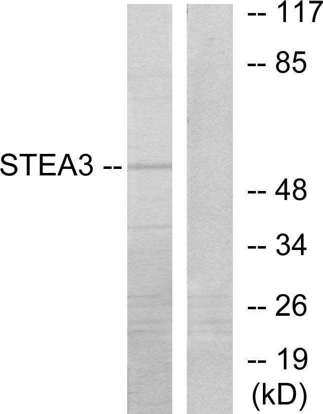 STEAP3 Ab