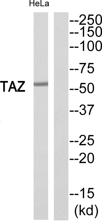 Tafazzin Ab