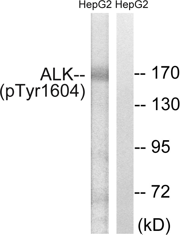 p-ALK (Y1604) Ab