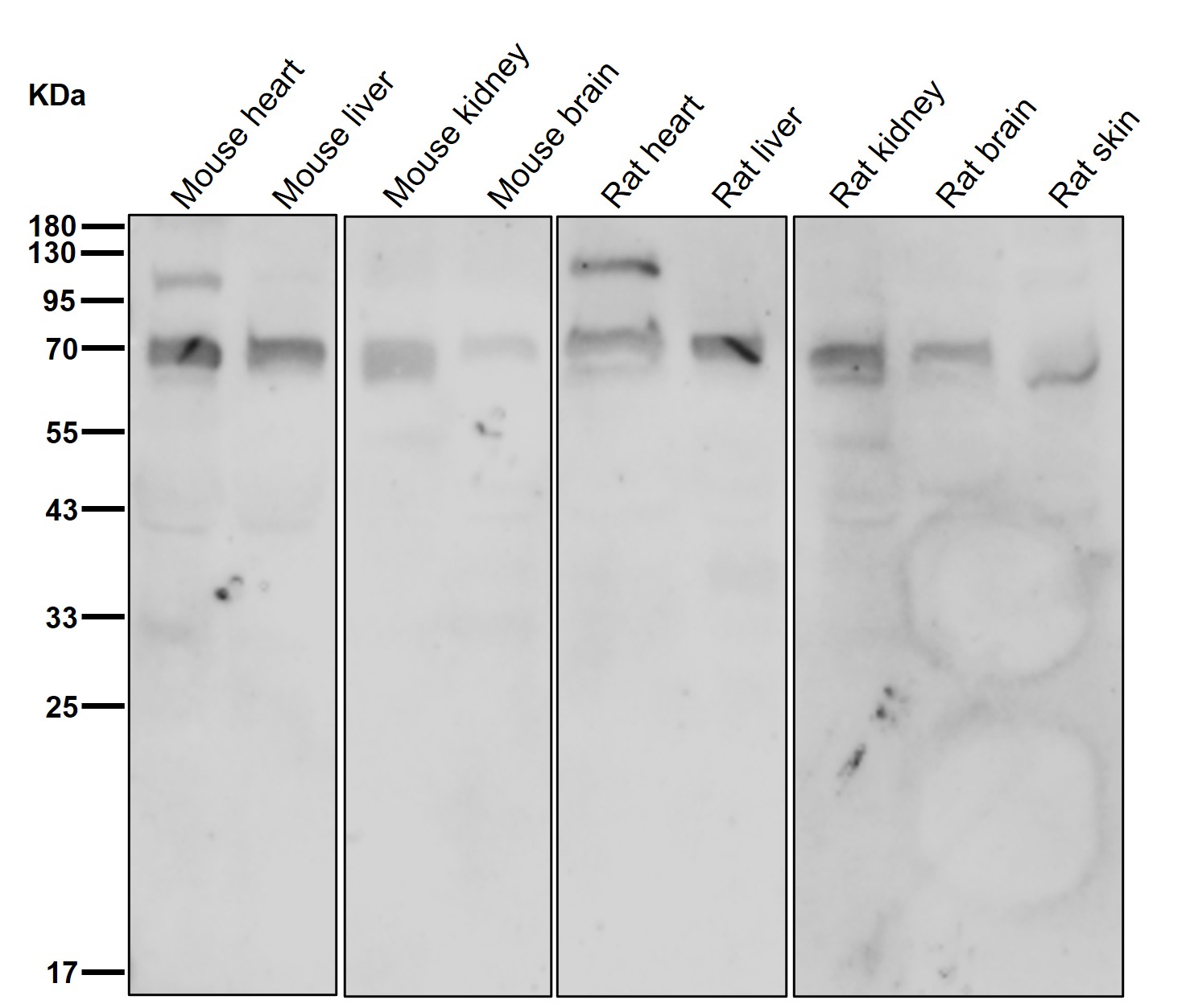 METTL14 Ab