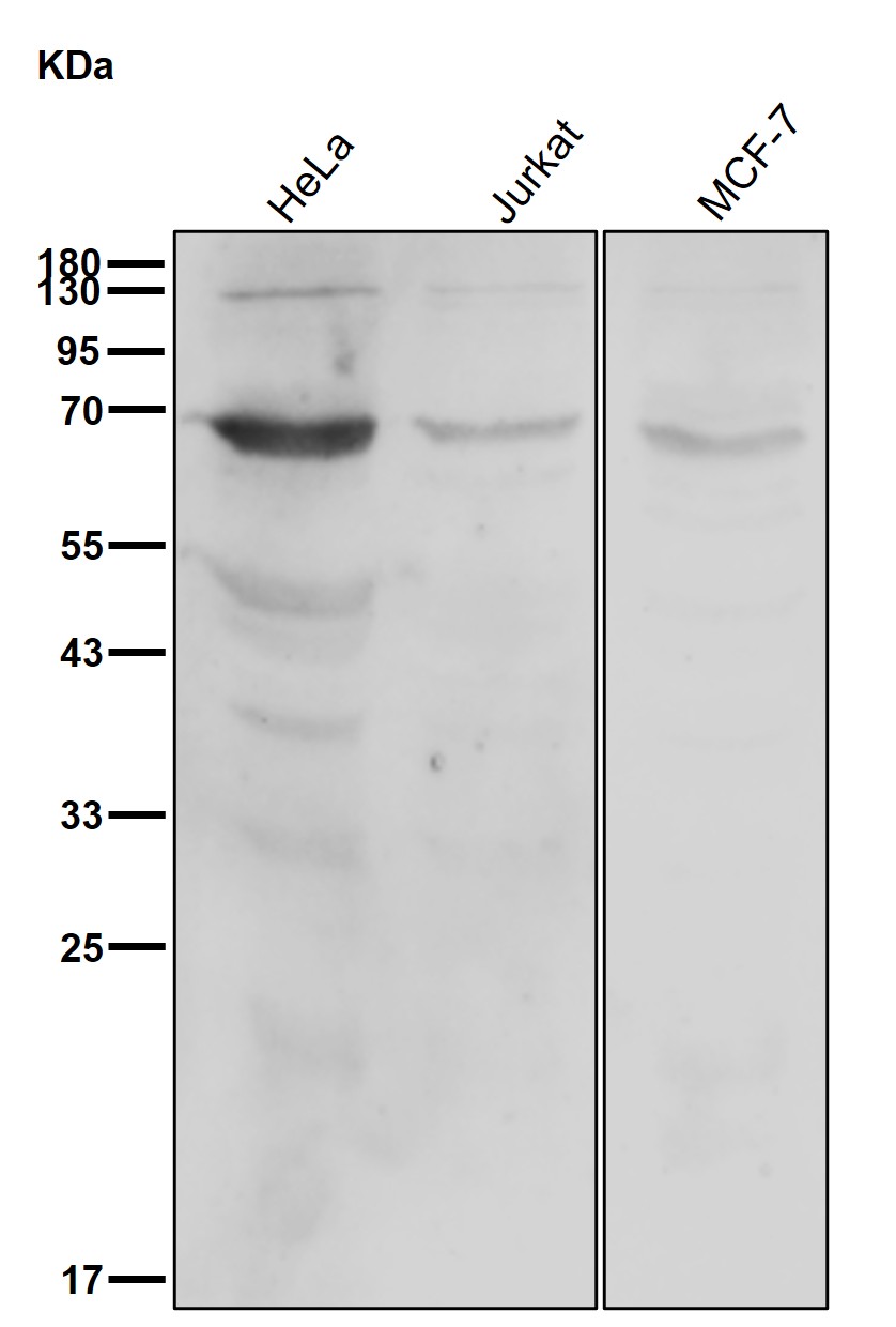 METTL14 Ab