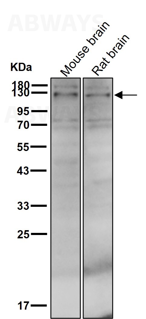 SREBF1 Ab