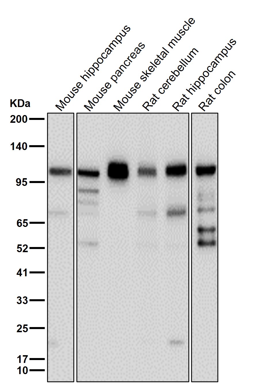 p-alpha Adducin (S436) Ab