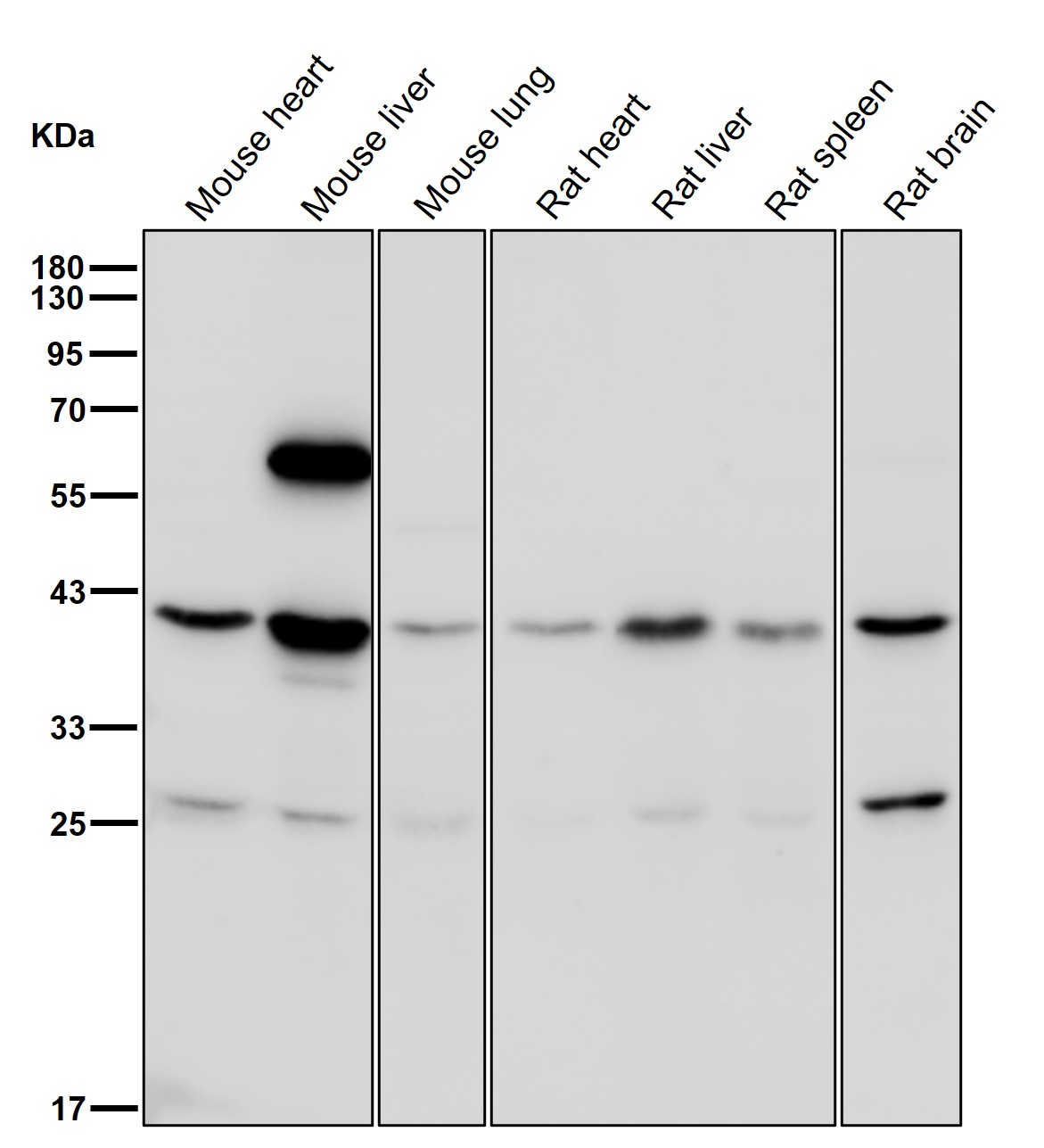 RPSA Ab