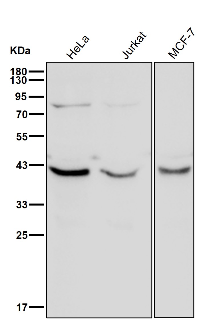 RPSA Ab