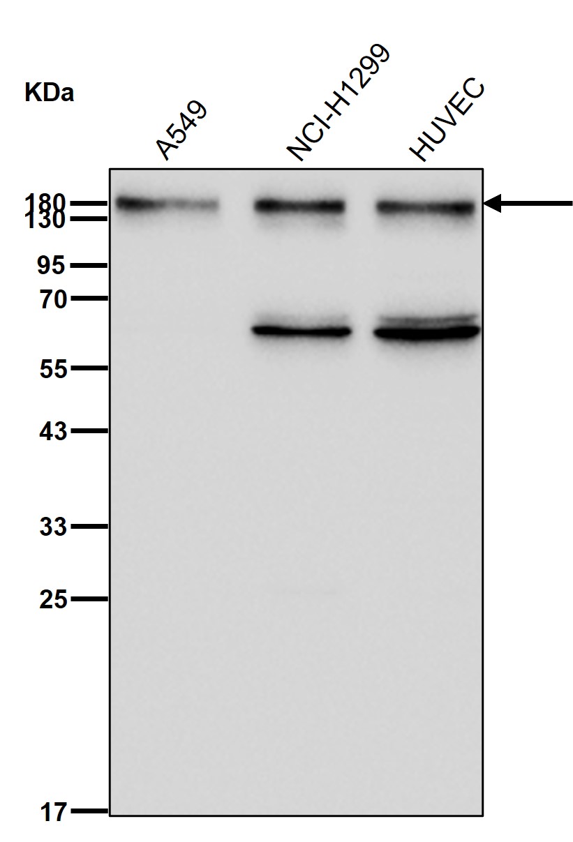 TARBP1 Ab
