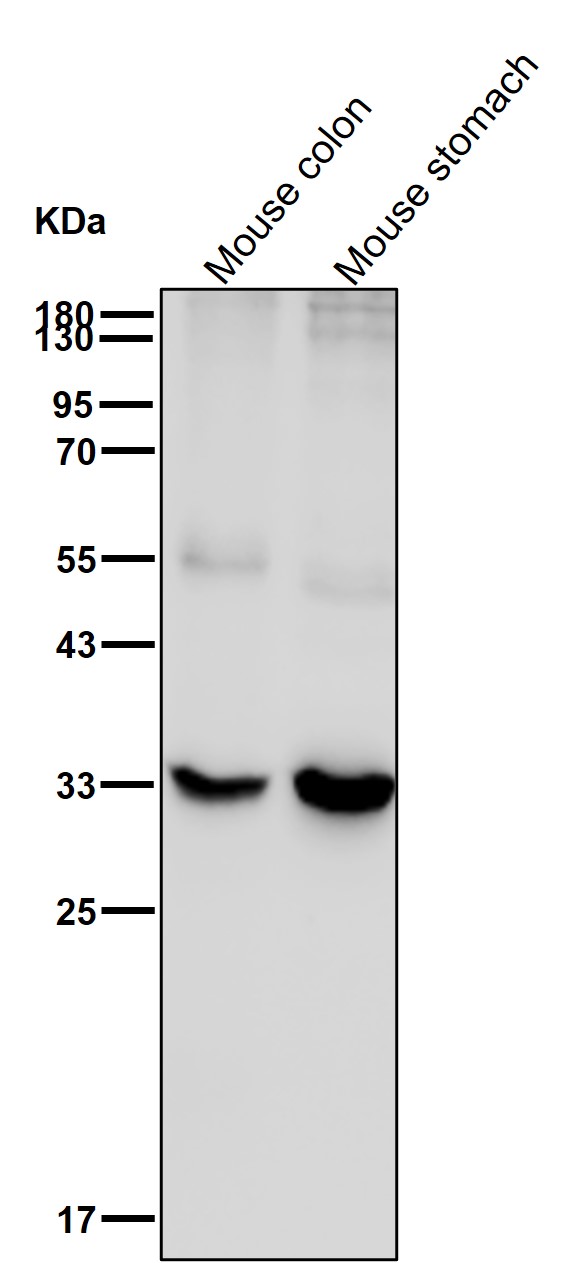 KCNMB3 Ab