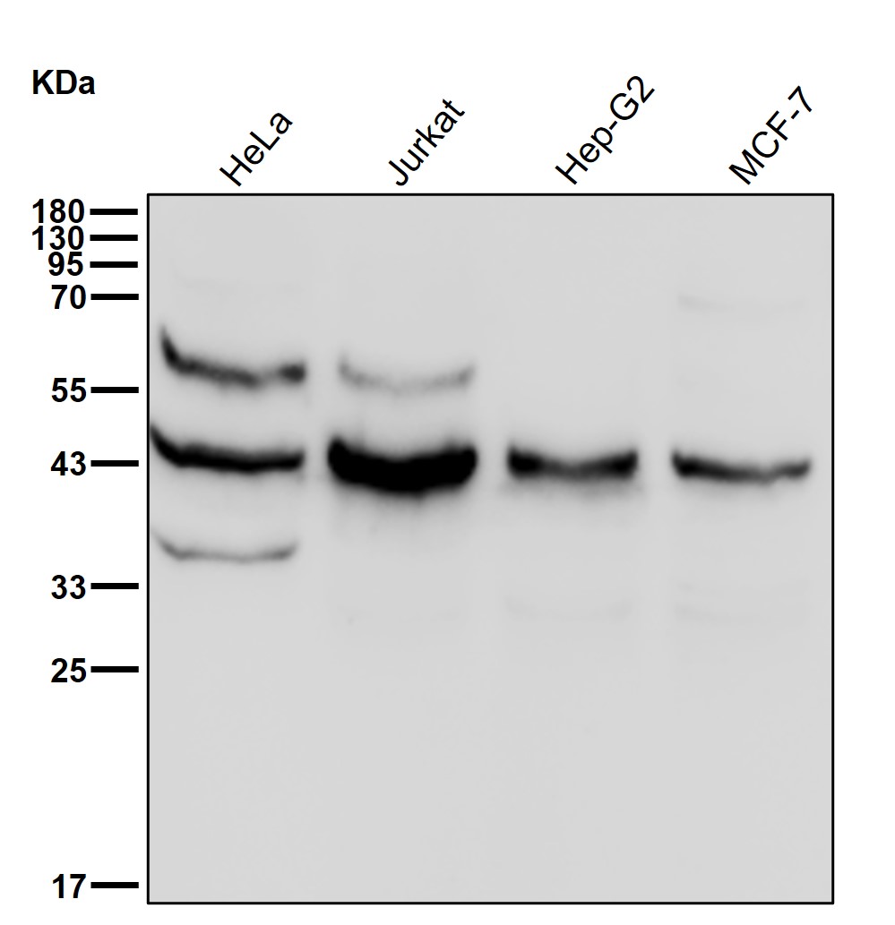 Ferrochelatase Ab