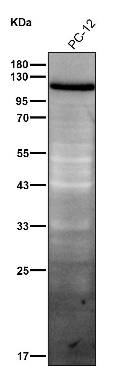 Ankycorbin Ab
