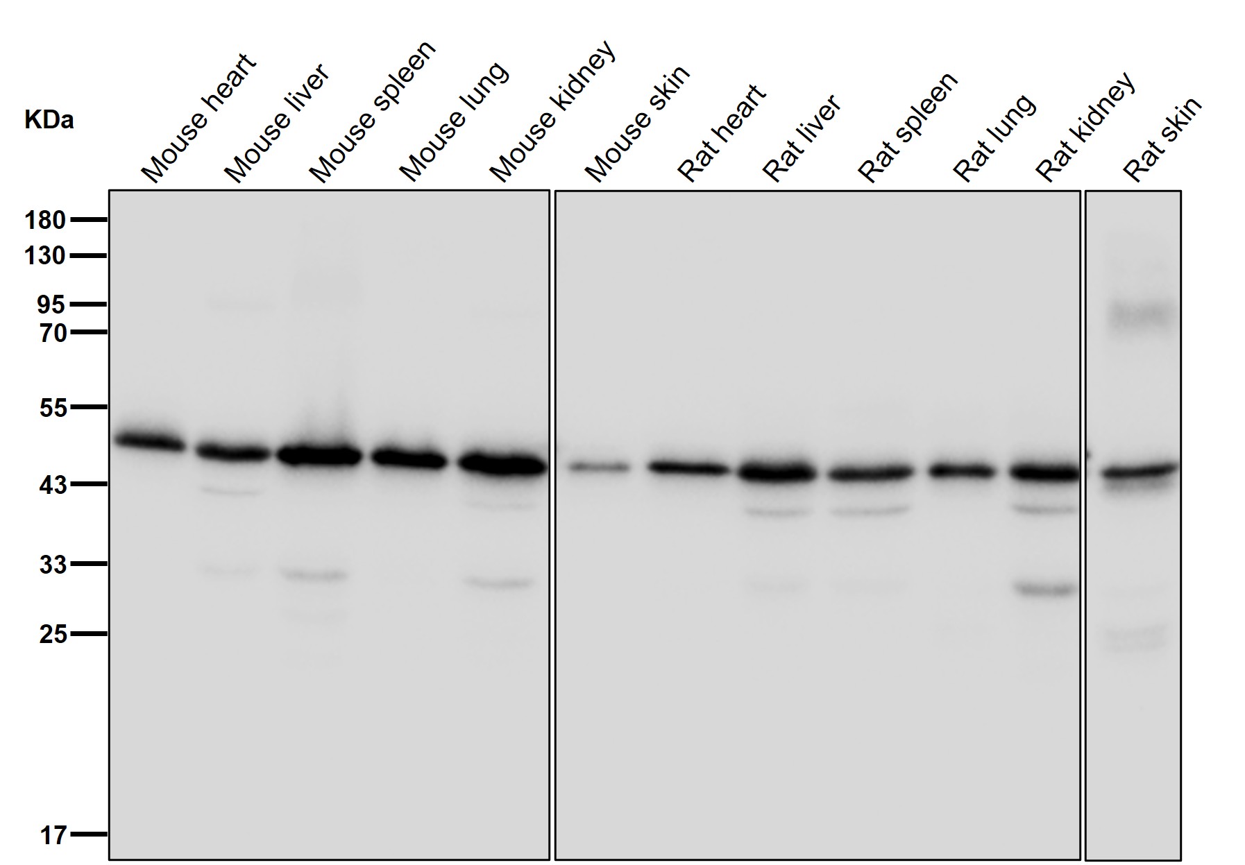 Actin like protein 6B Ab