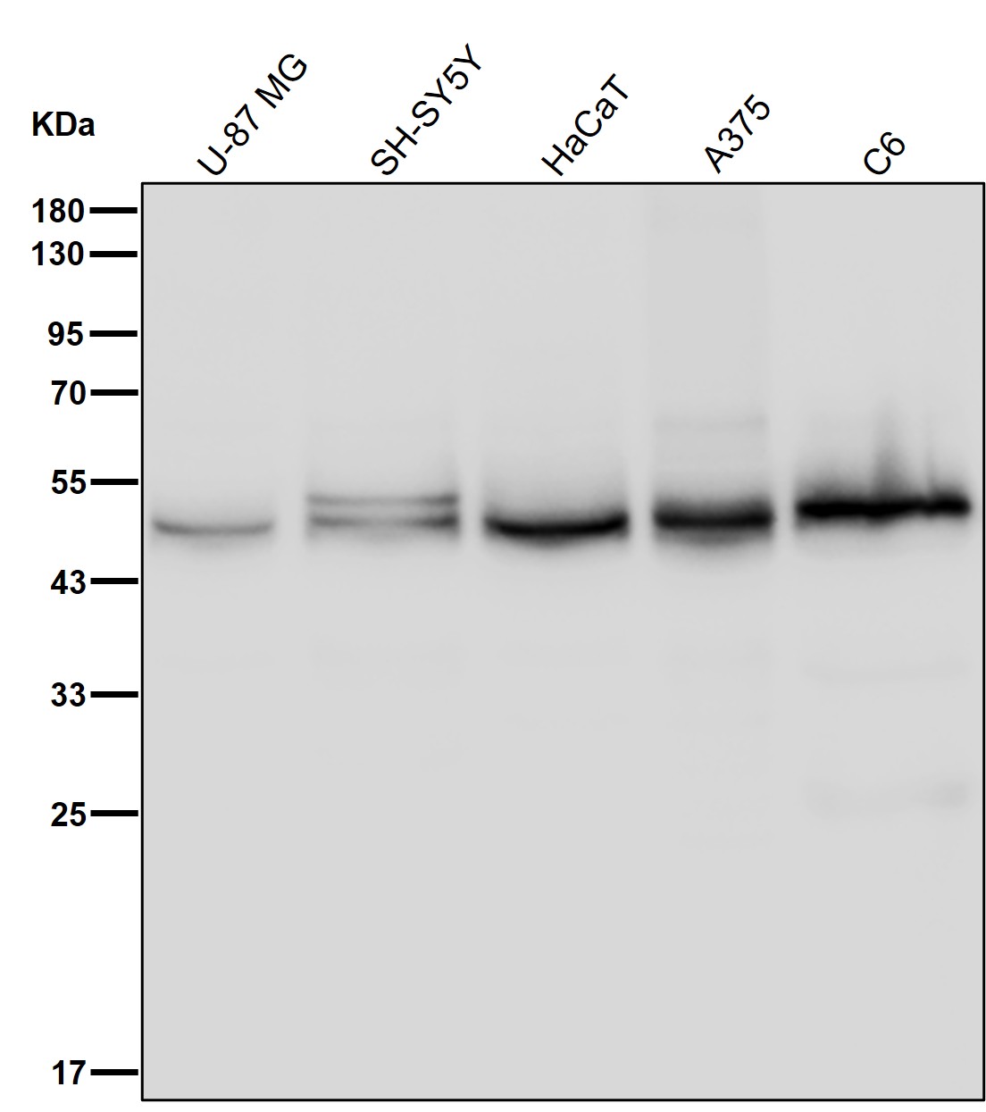 Actin like protein 6B Ab